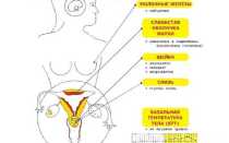 Недостаток прогестерона у женщин