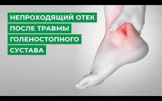 Как снять отек ноги после перелома