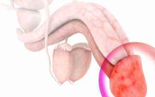 Трещины на половом члене — что это такое и как с этим справиться