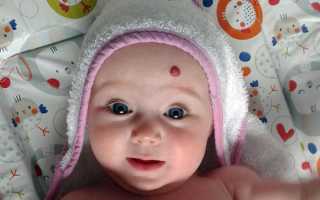 Появилось красное пятно на лбу новорожденного — что это и как лечить, советы специалистов