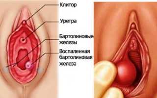 Почему появилось уплотнение на половых губах? Узнайте причины и советы