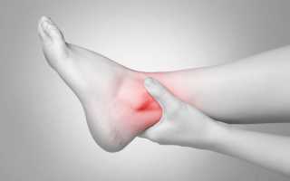 Артрит голеностопного сустава