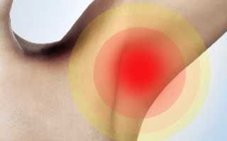 Почему чешутся подмышки? Узнайте причины и решения