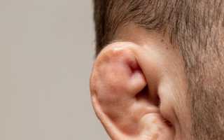 Перелом уха
