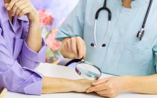 Отходят ногти от кожи на руках — почему и что делать для здоровья?