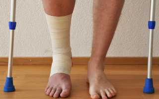 Температура при переломе