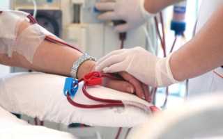 Диализ почек что это сколько живут