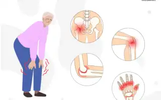 Серонегативный ревматоидный артрит