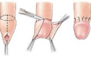 Что делать, если не открывается головка? Полезные советы и рекомендации