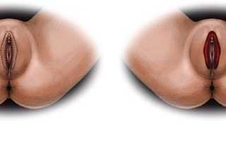 Почему опухли половые губы и что делать в такой ситуации