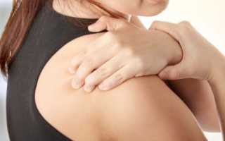 Вывих плеча