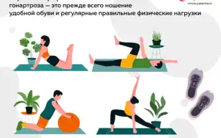 Профилактика артроза