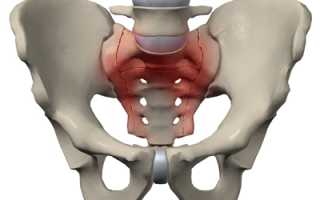 Перелом крестца