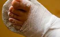 Лонгетные повязки