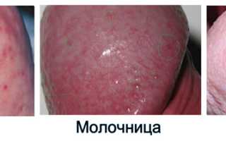 Пупырышки на половом члене — что делать, если появились, и как избежать