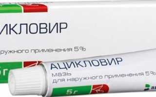 Почему появляется белый налет и зуд на головке у мужчин? Причины и рекомендации