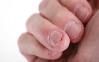 Почему ломаются ногти на руках? Причины и советы