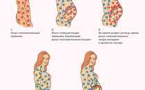 Мифы о совместимости крови при беременности