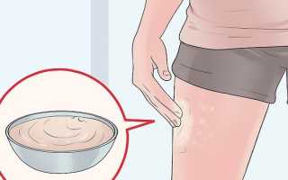 Розовые пятна на коже — все про них и их причины