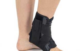 Ортез для стопы