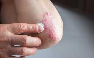 Почему чешутся руки до локтя? Узнайте причины и решения