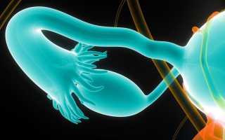 Восстановление маточных труб после удаления