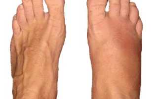 Маршевая стопа