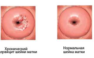 Выделения после секса — нормально ли это для здоровья?