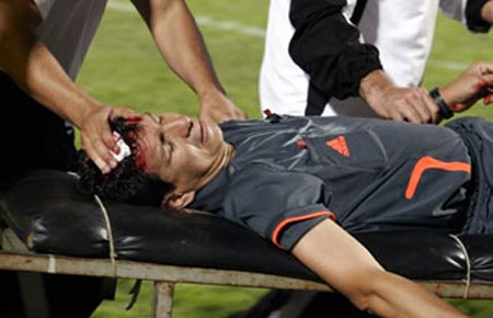 футболист-на-носилках