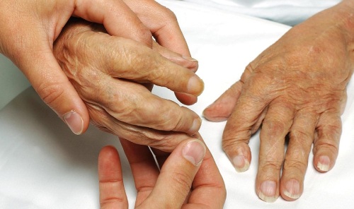 руки-больного-гипокальциемией