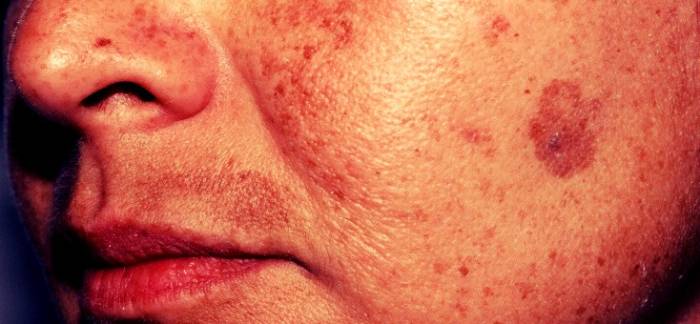 prichiny-poyavleniya